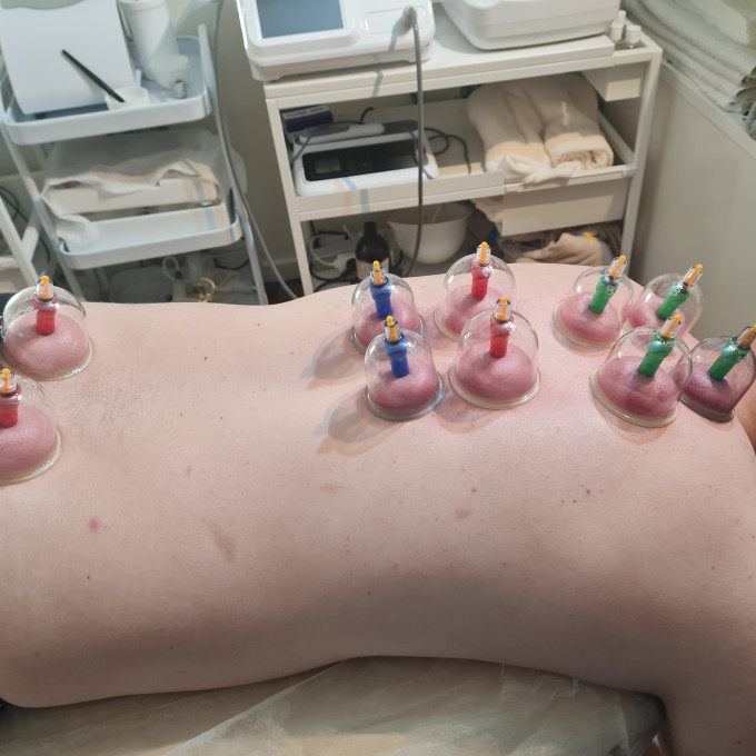 Effektiv vakuumterapi, der øger blodgennemstrømningen og løsner dybe spændinger.