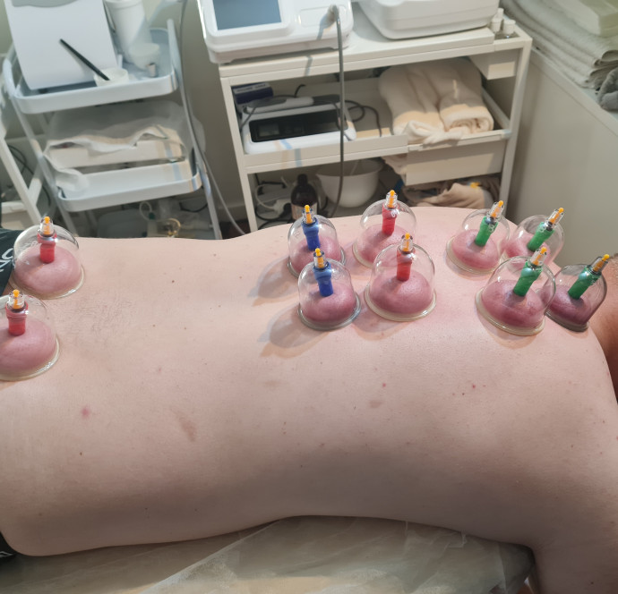 Dybdegående bindevævsmassage med Cupping for bedre cirkulation og færre spændinger.